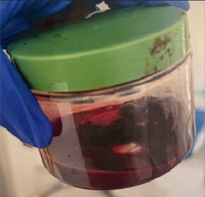 Unusual Culprit: Upper Gastrointestinal Bleed Following Influenza-A Infection in a Child